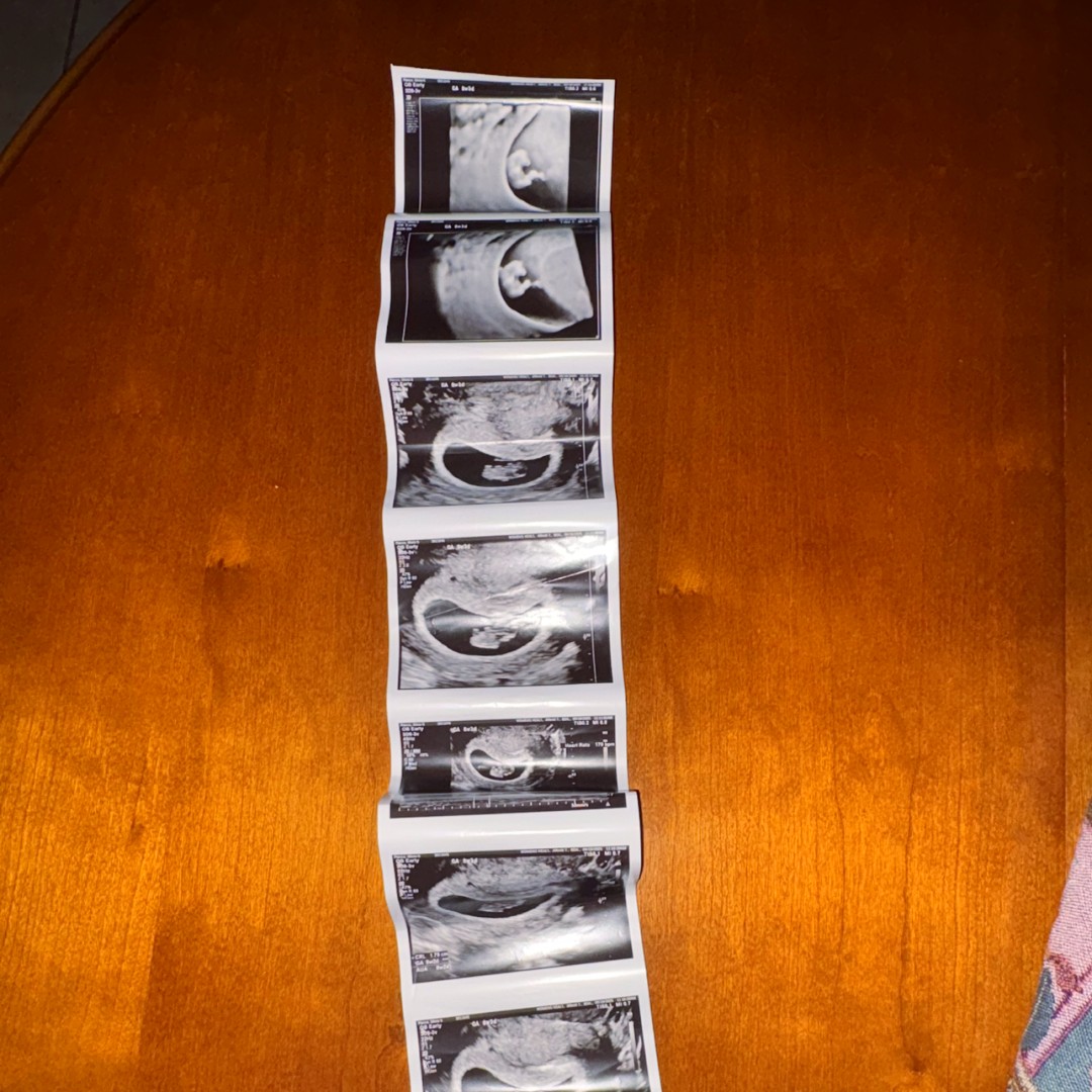 Photo shared by Olivia for their Babylist baby registry.