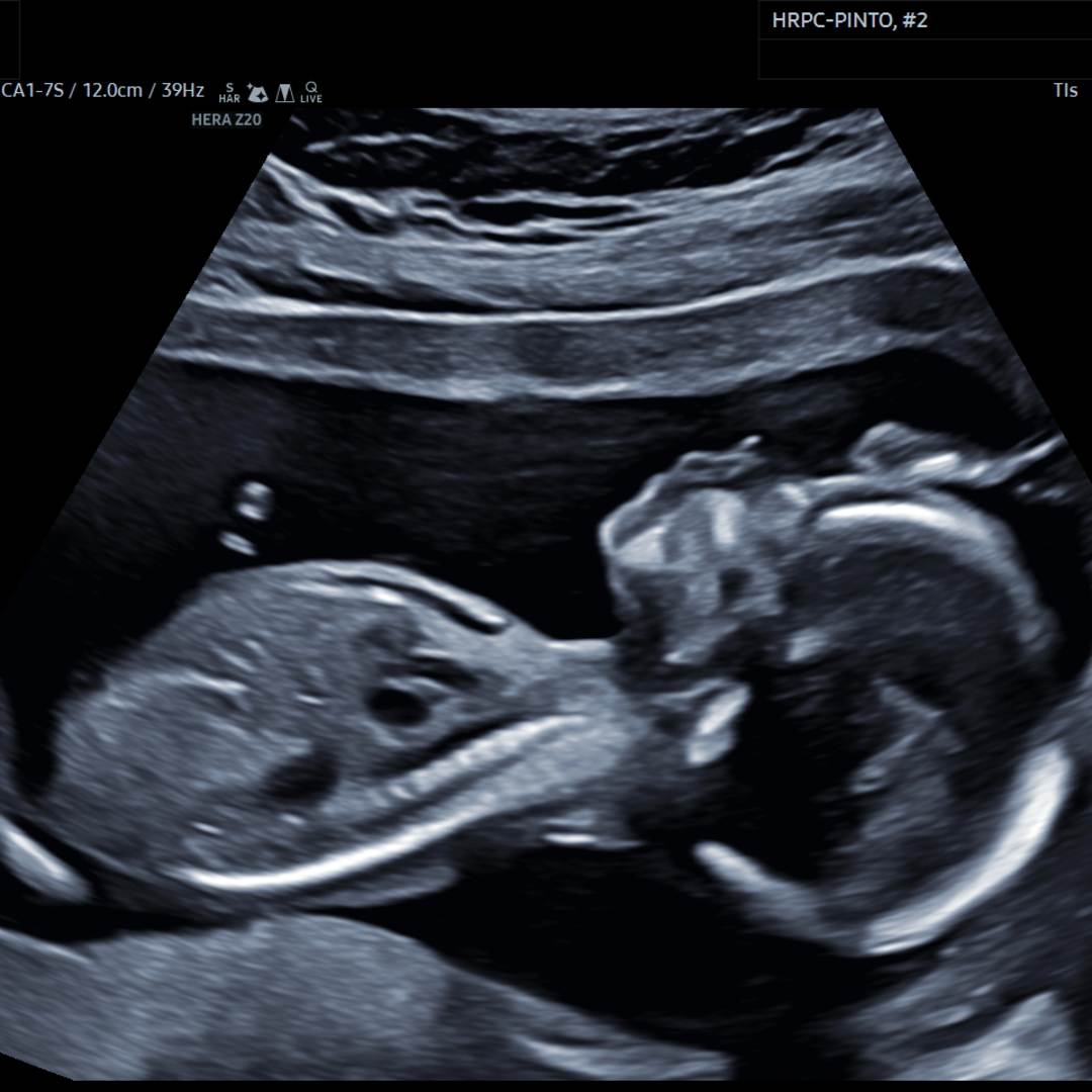 Photo shared by Shaterrika for their Babylist baby registry.