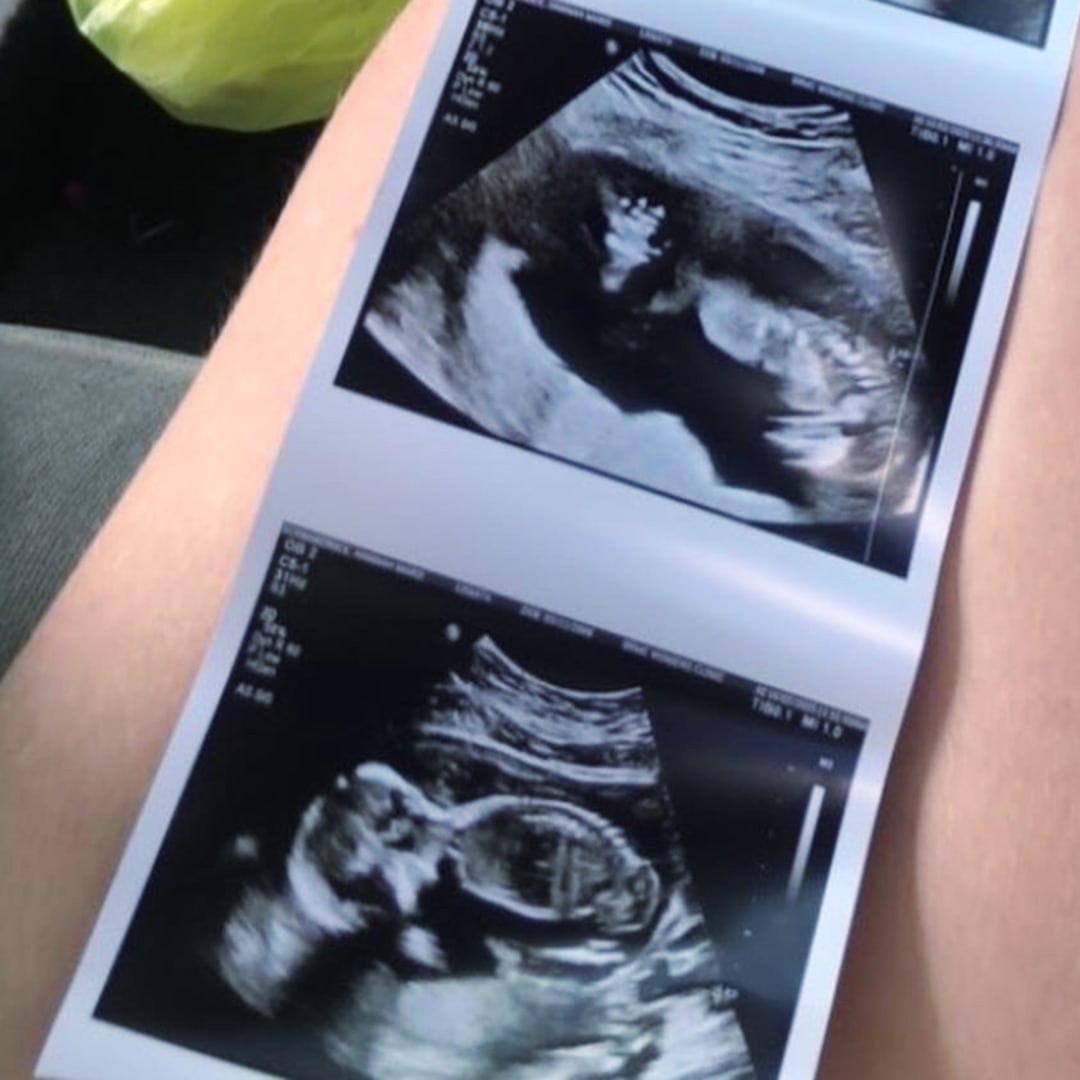 Photo shared by Andi for their Babylist baby registry.