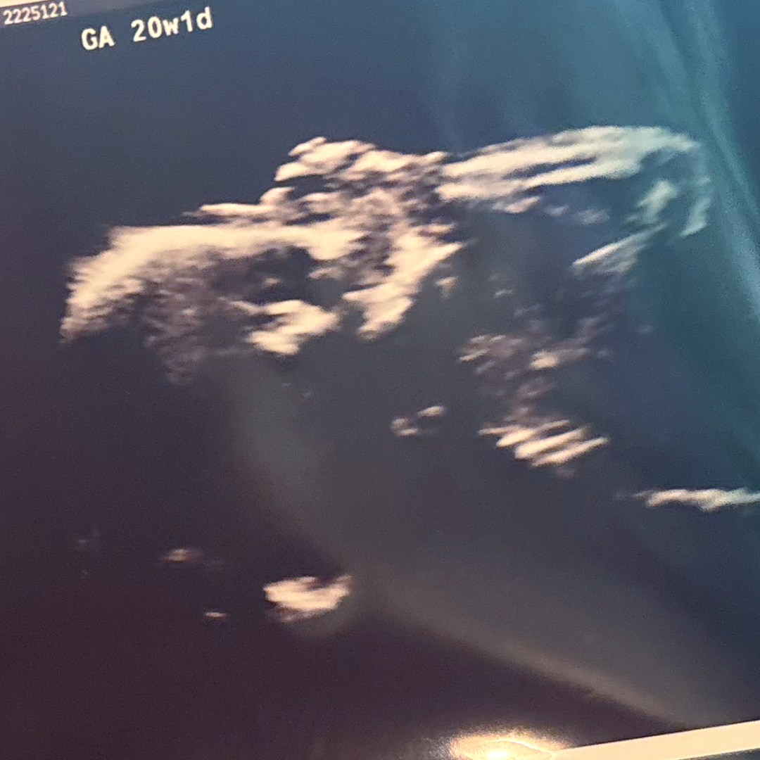 Photo shared by Nicole for their Babylist baby registry.