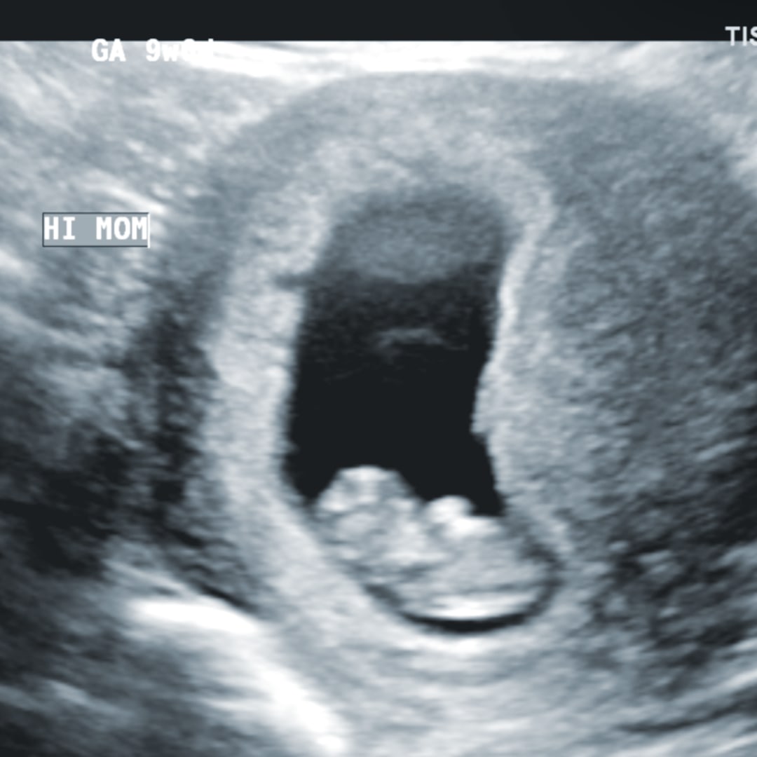 Photo shared by Analise for their Babylist baby registry.