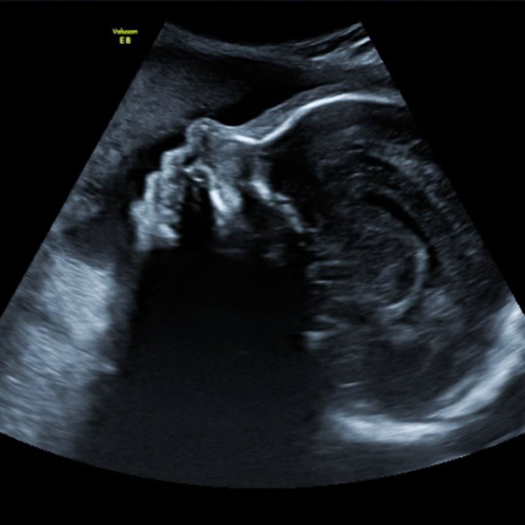 Photo shared by Jacey for their Babylist baby registry.