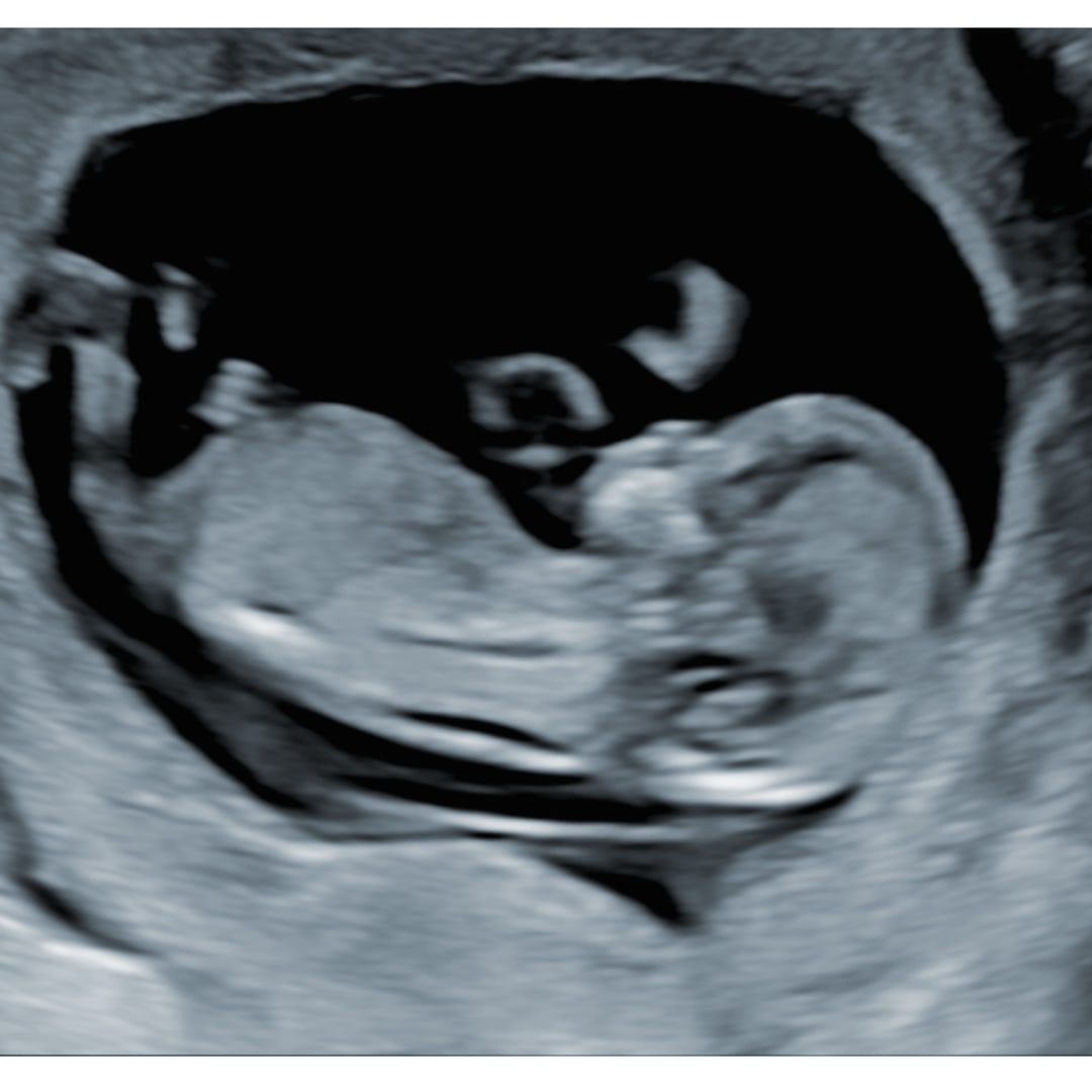 Photo shared by Carly for their Babylist baby registry.