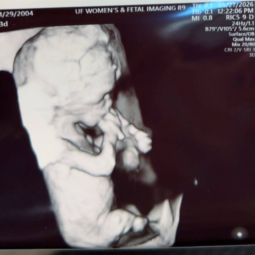 Photo shared by Ashlee for their Babylist baby registry.