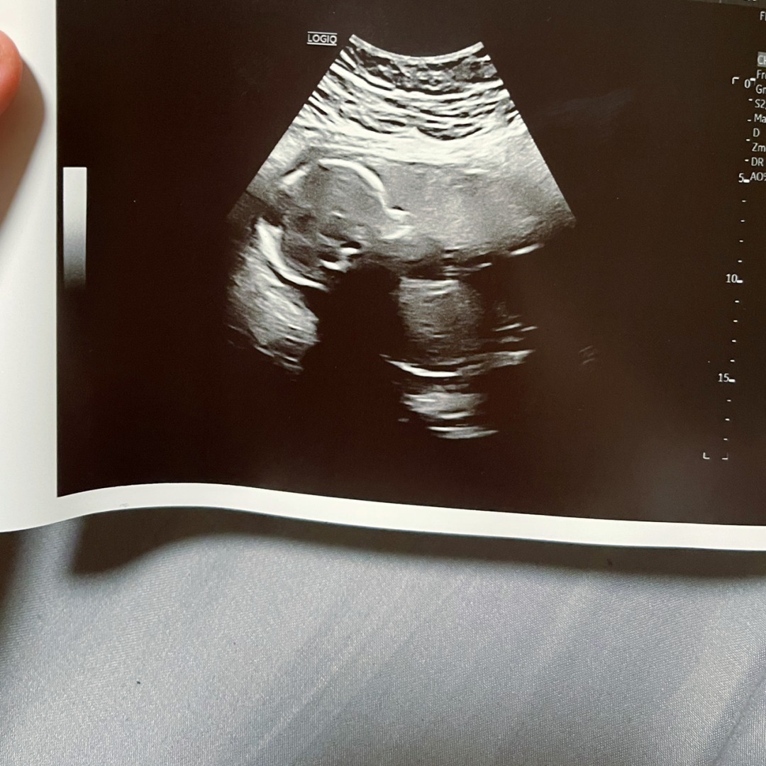 Photo shared by Delanie for their Babylist baby registry.