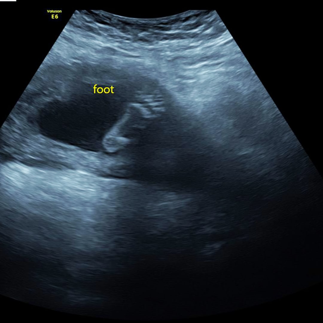 Photo shared by Celeste for their Babylist baby registry.
