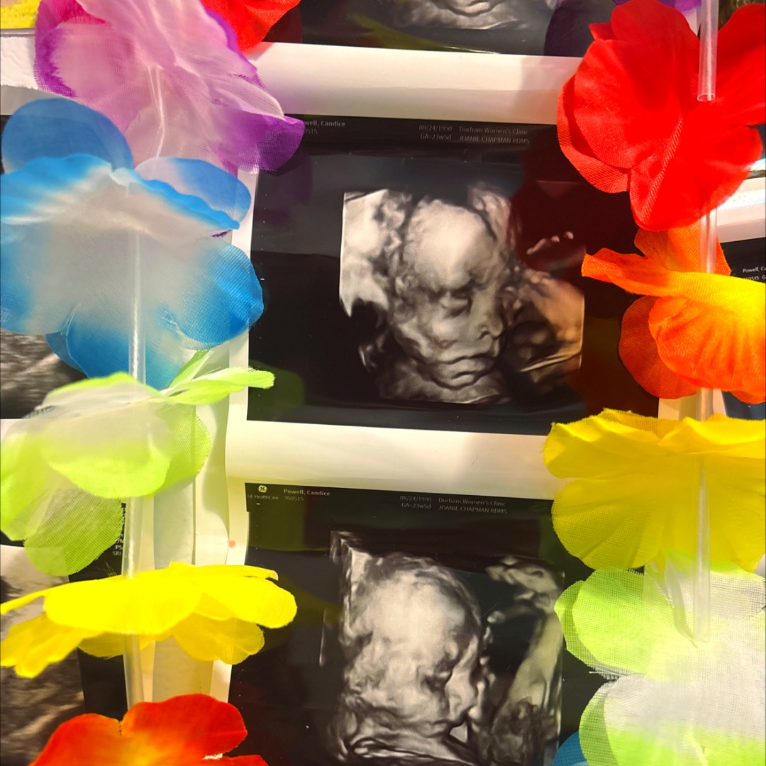 Photo shared by Candice for their Babylist baby registry.
