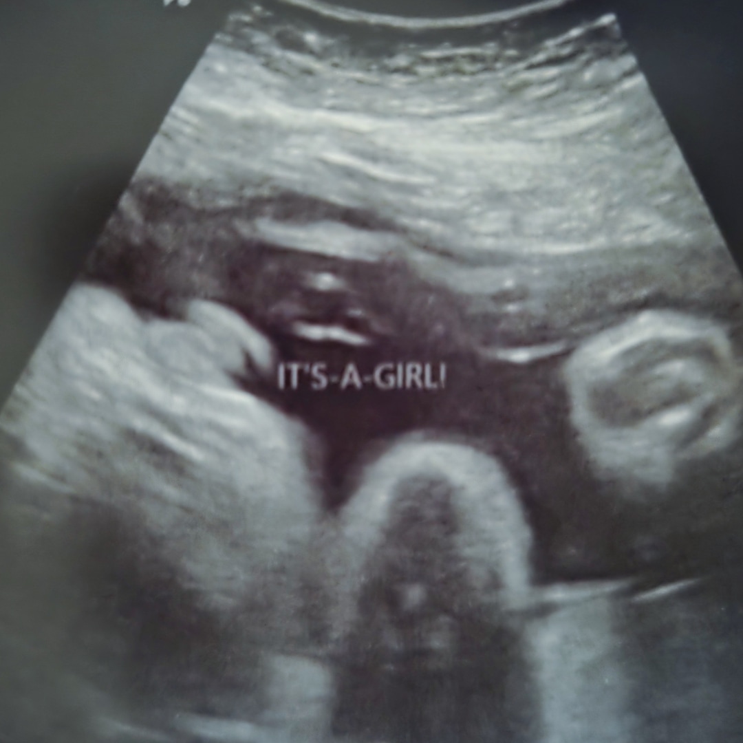 Photo shared by Ashley for their Babylist baby registry.