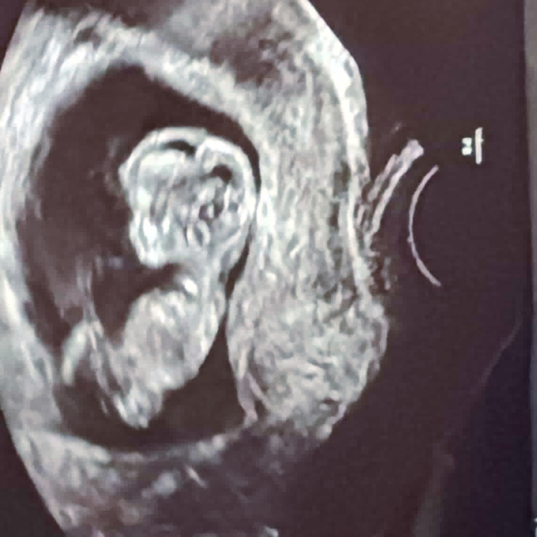 Photo shared by Edith for their Babylist baby registry.