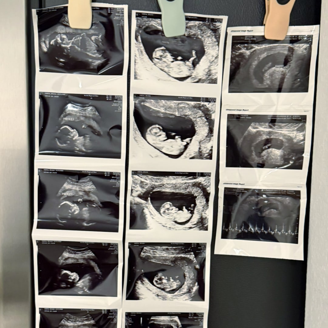 Photo shared by Briana for their Babylist baby registry.