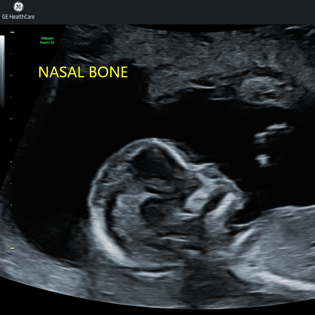 Photo shared by Charmaine for their Babylist baby registry.