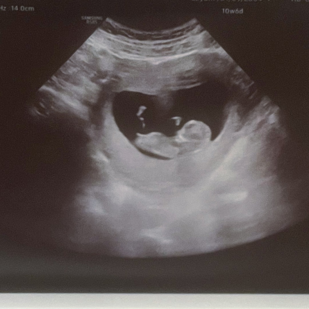 Photo shared by Callie for their Babylist baby registry.