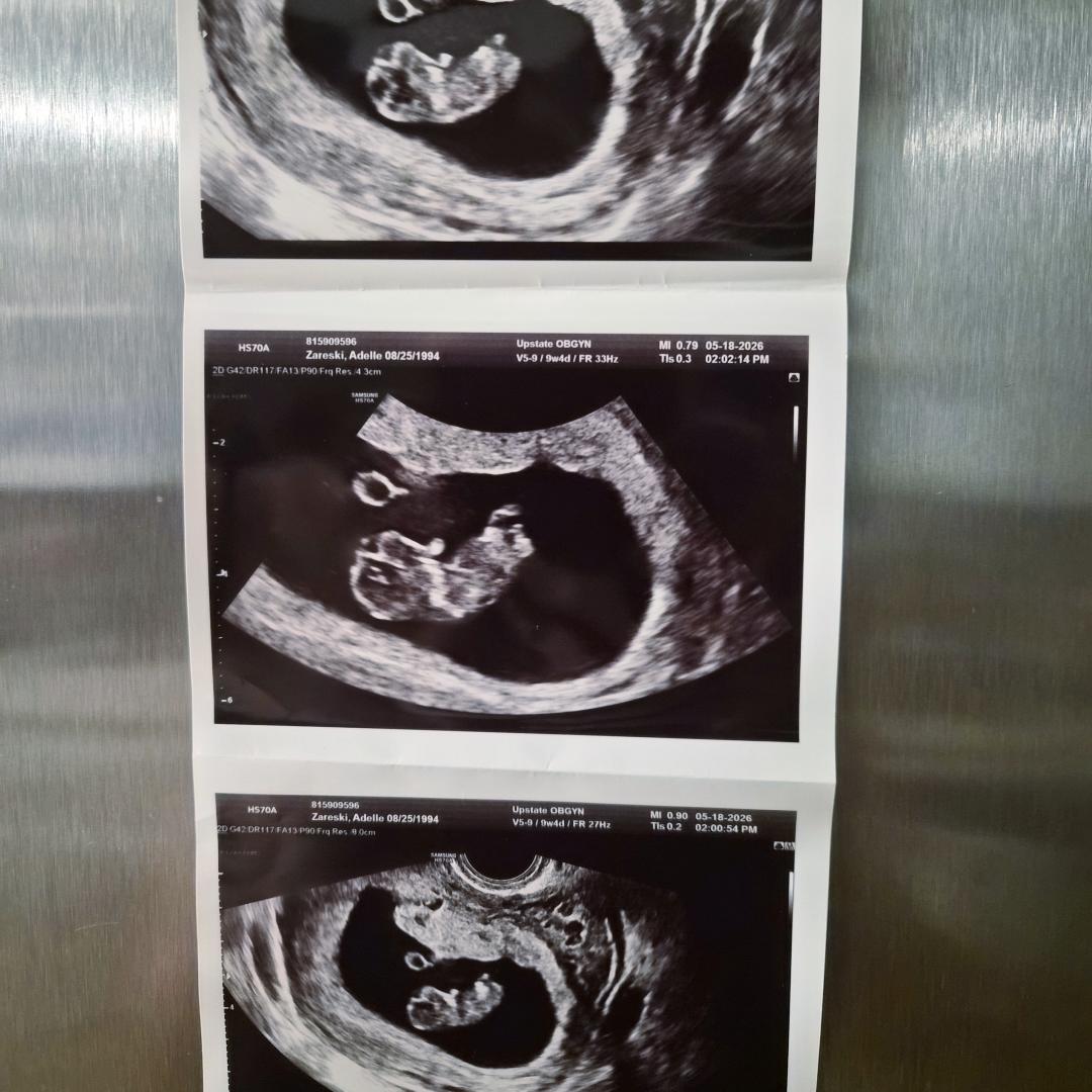 Photo shared by Adelle for their Babylist baby registry.