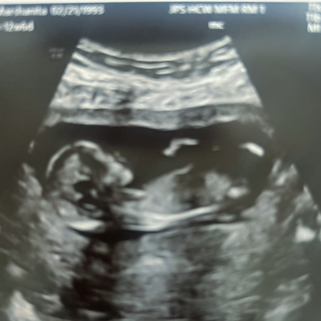 Photo shared by Marshanita for their Babylist baby registry.
