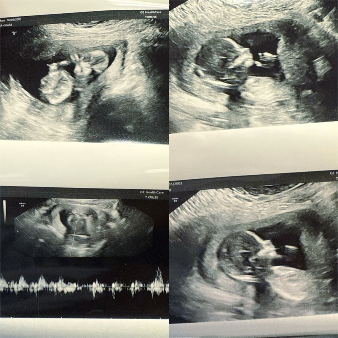 Photo shared by Sahara for their Babylist baby registry.