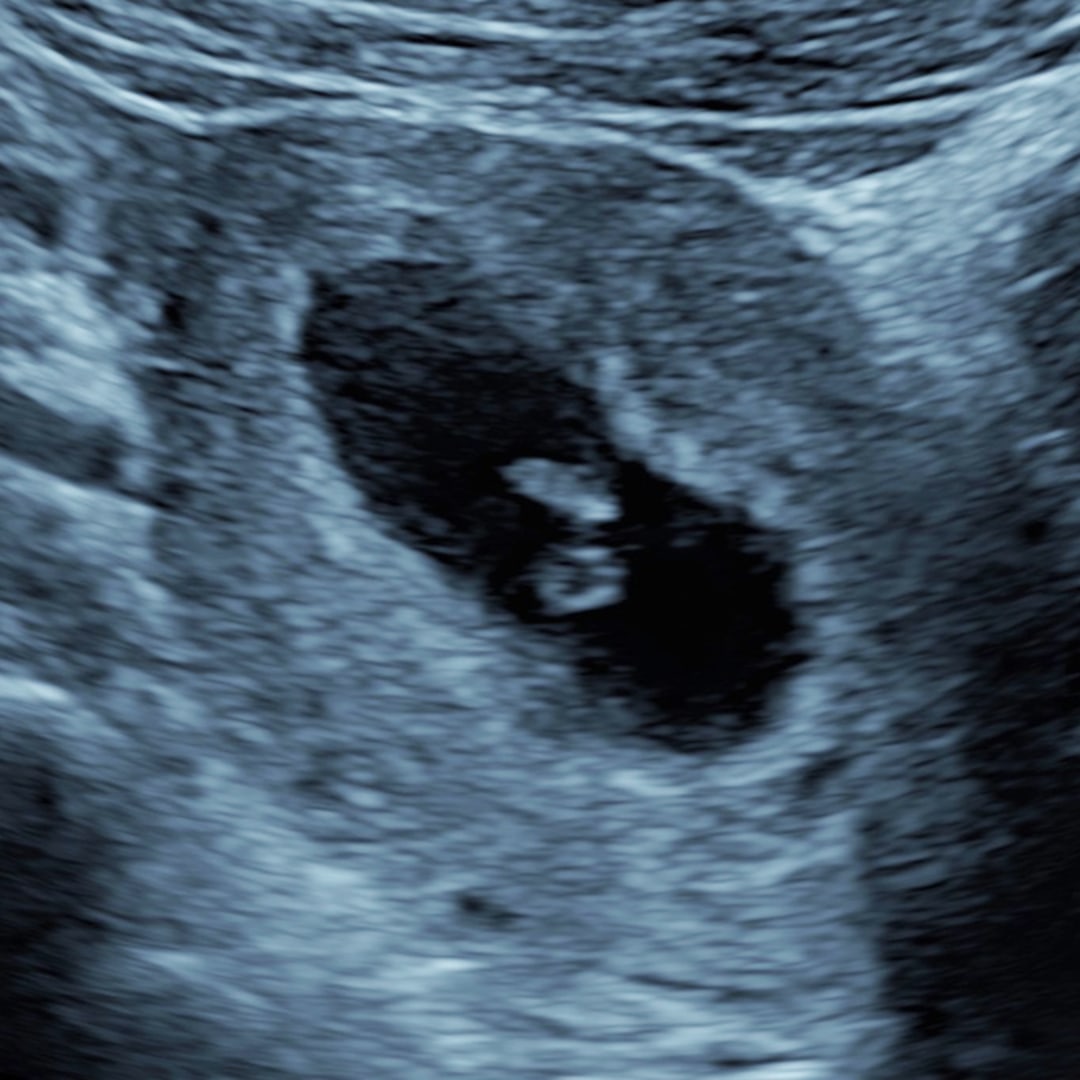 Photo shared by Deyana for their Babylist baby registry.