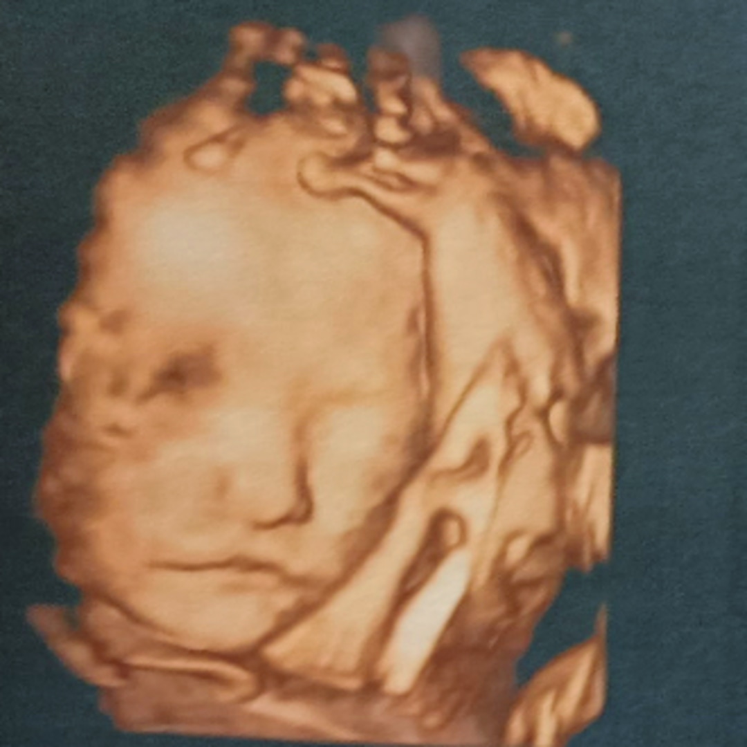 Photo shared by Martha for their Babylist baby registry.