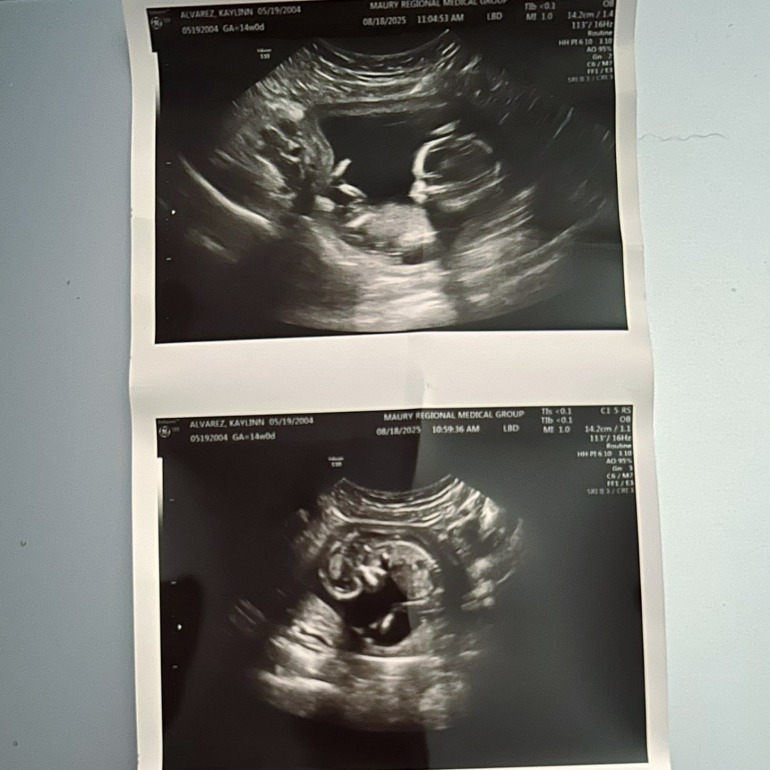 Photo shared by Kaylinn for their Babylist baby registry.