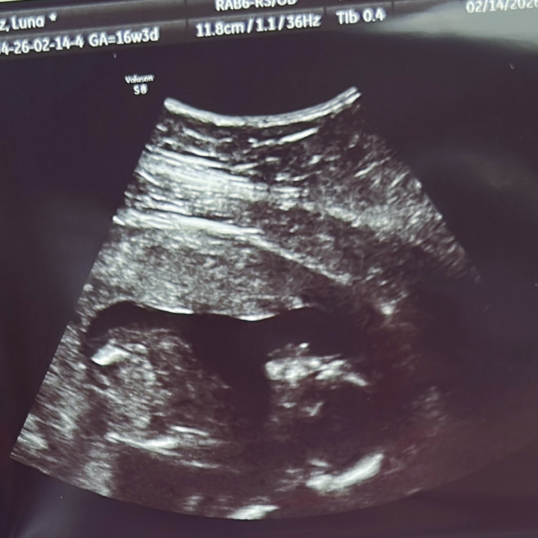 Photo shared by Luna for their Babylist baby registry.