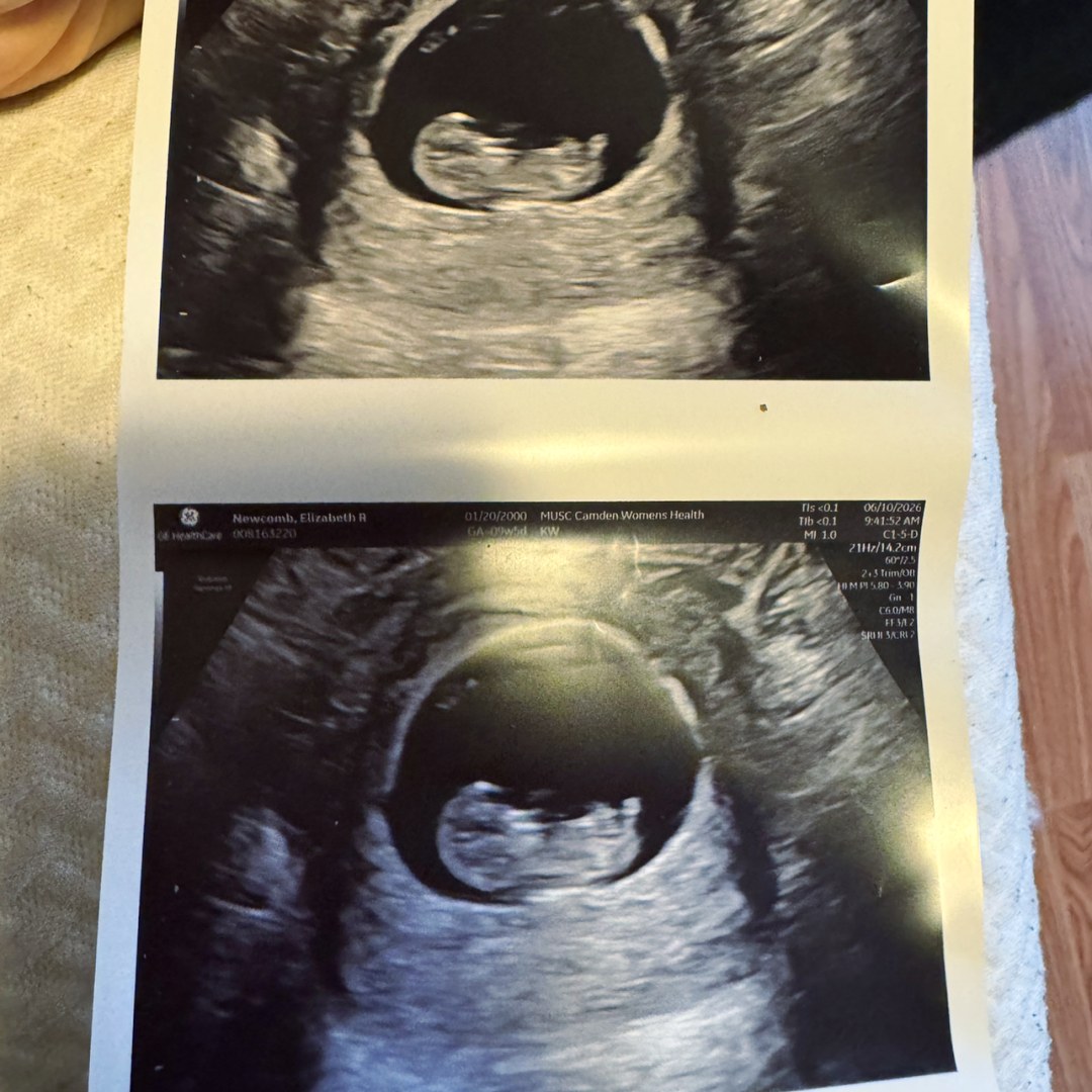Photo shared by Elizabeth for their Babylist baby registry.