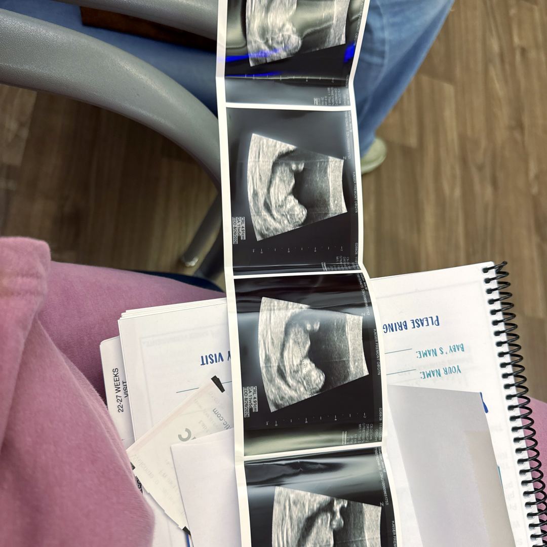 Photo shared by Ann for their Babylist baby registry.