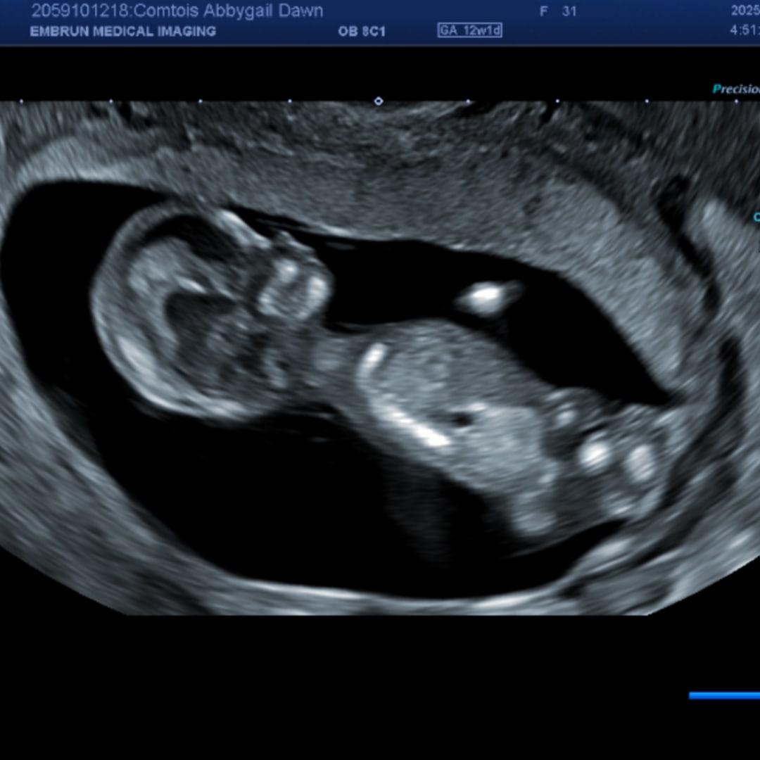 Photo shared by Abbygail for their Babylist baby registry.