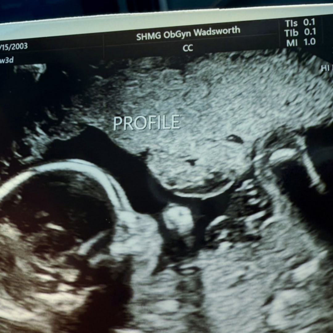 Photo shared by Julia for their Babylist baby registry.