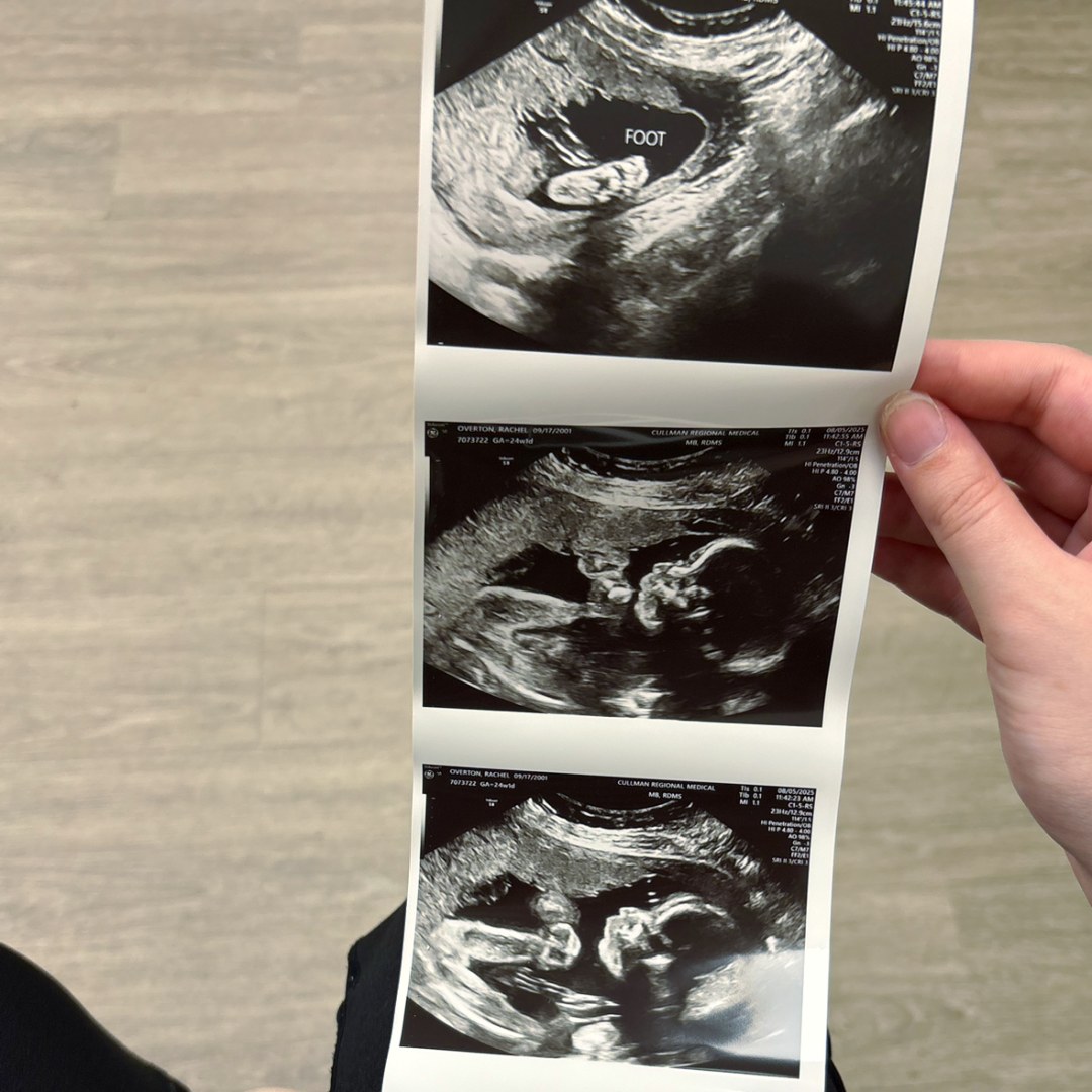 Photo shared by Rachel for their Babylist baby registry.