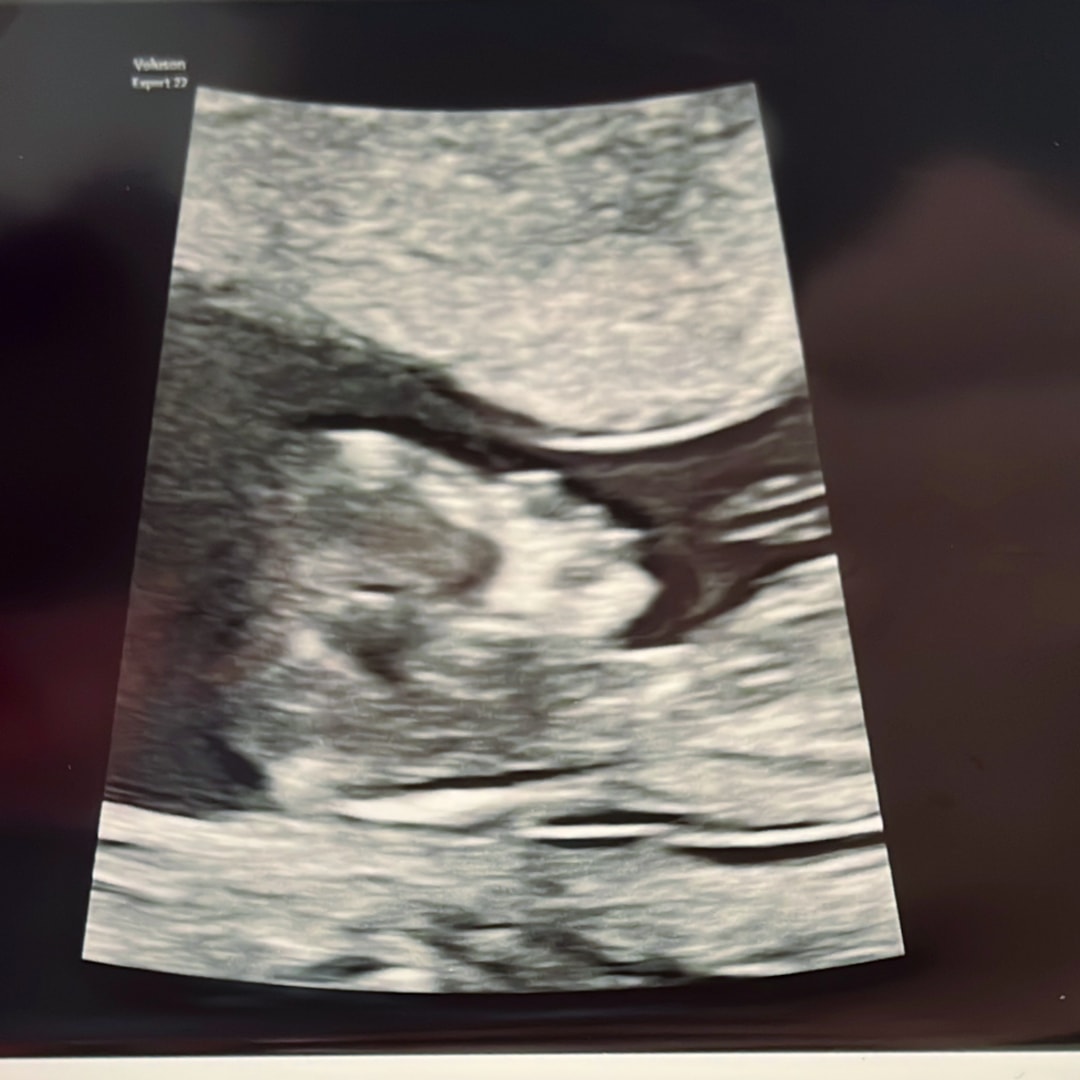 Photo shared by Gabriela for their Babylist baby registry.