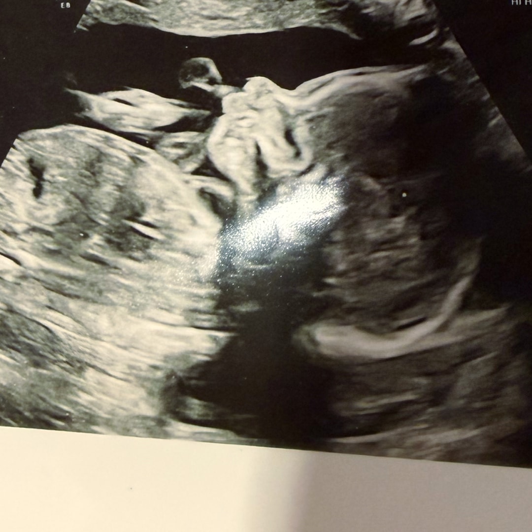 Photo shared by Kaitlin for their Babylist baby registry.