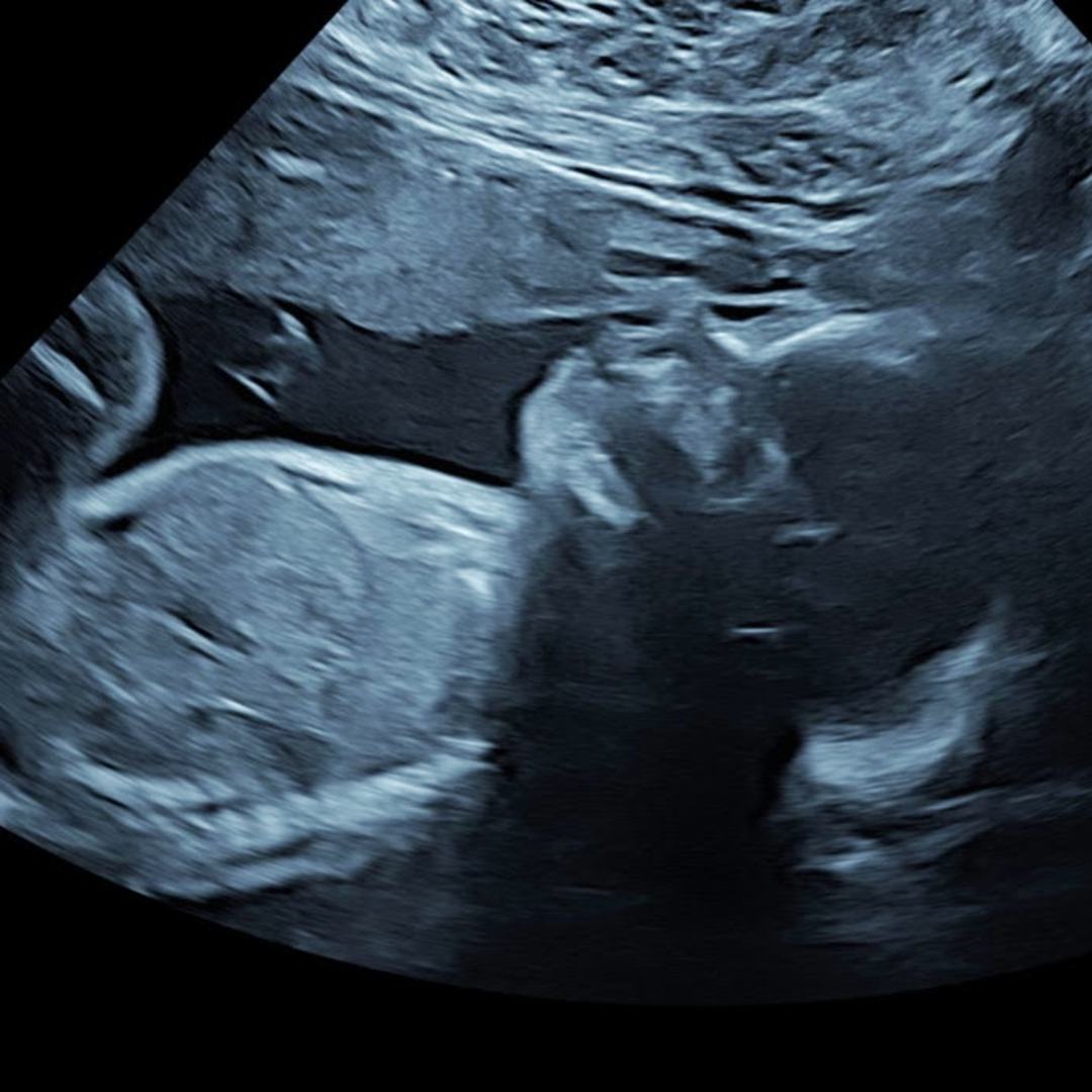 Photo shared by Katrina for their Babylist baby registry.