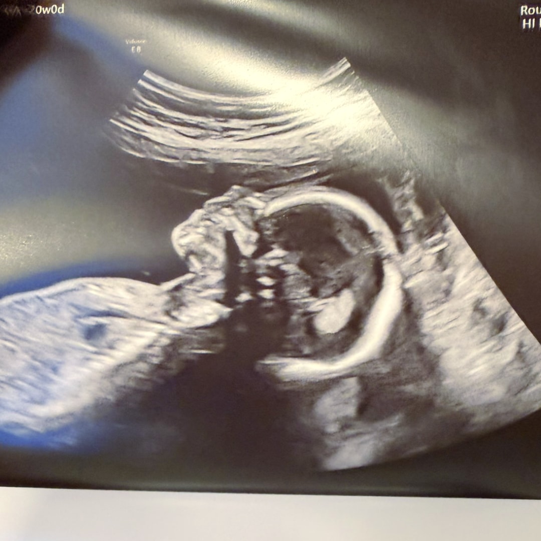 Photo shared by Shay for their Babylist baby registry.