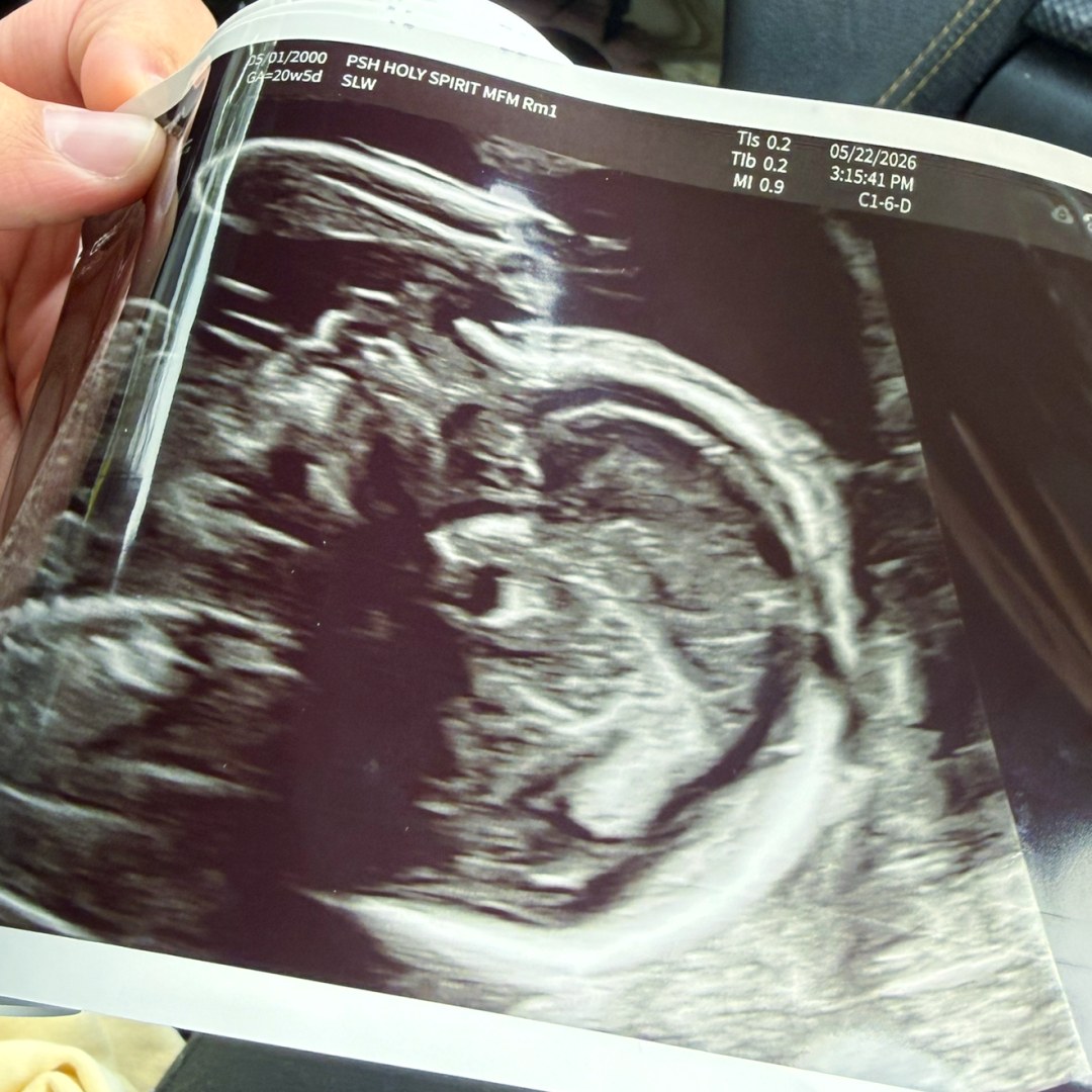 Photo shared by Autumn for their Babylist baby registry.
