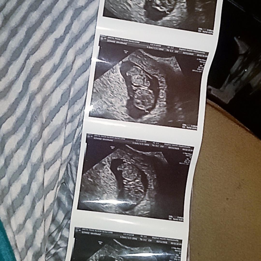 Photo shared by Paige for their Babylist baby registry.