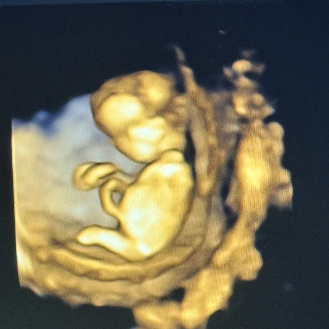 Photo shared by Lucia for their Babylist baby registry.