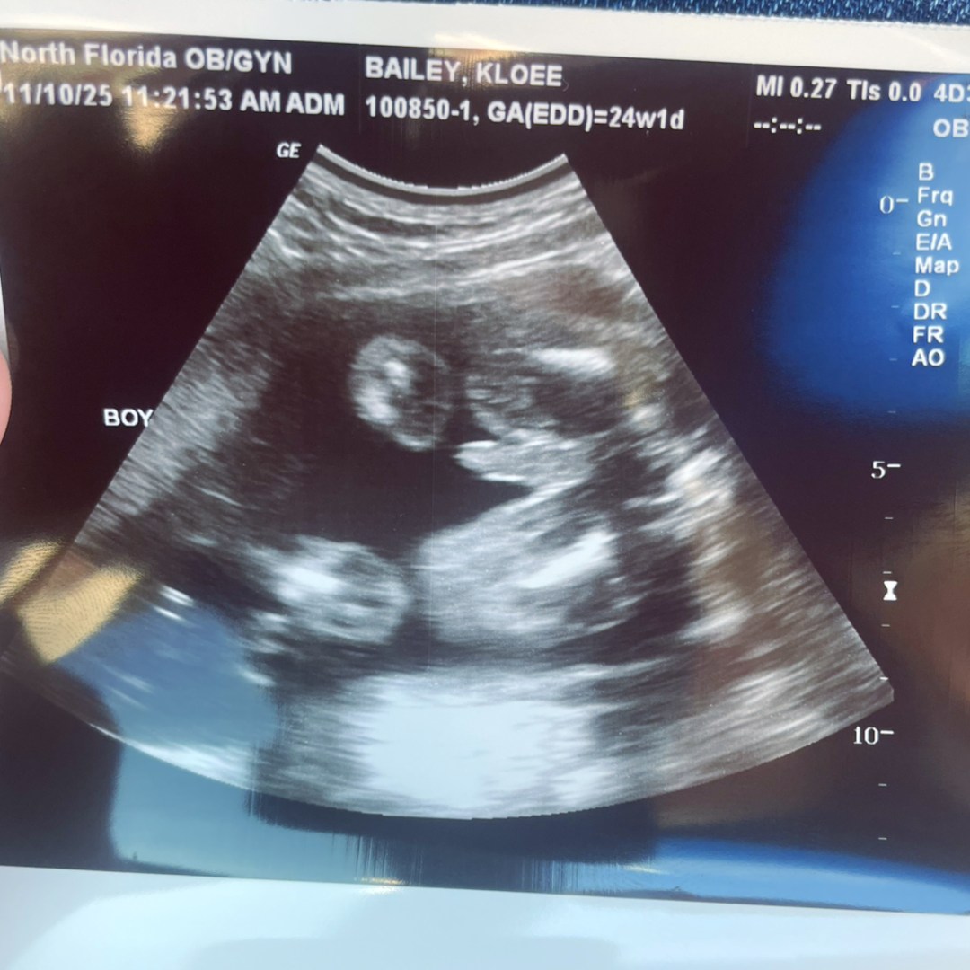 Photo shared by Kloee for their Babylist baby registry.