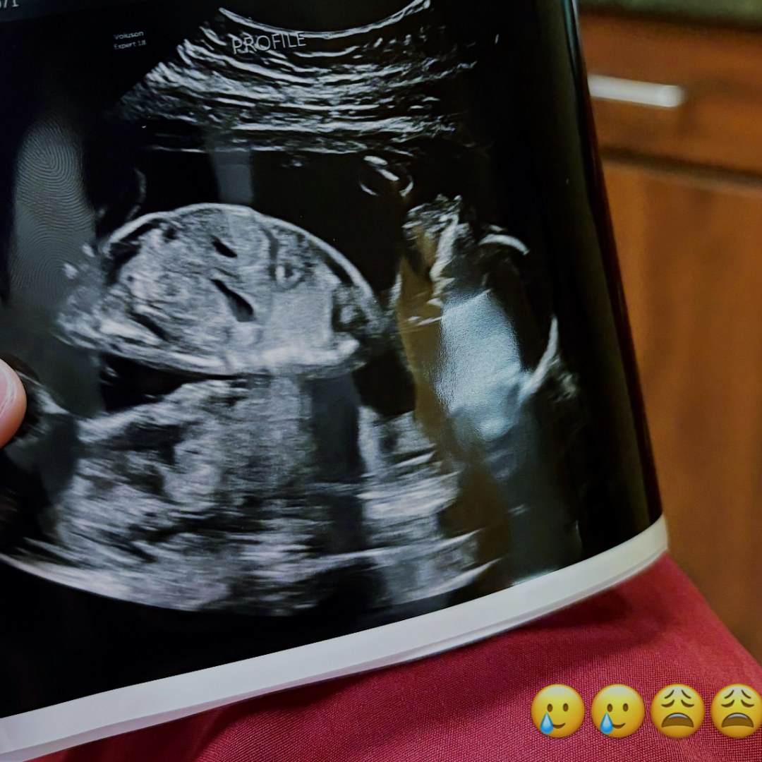 Photo shared by Jahmea for their Babylist baby registry.