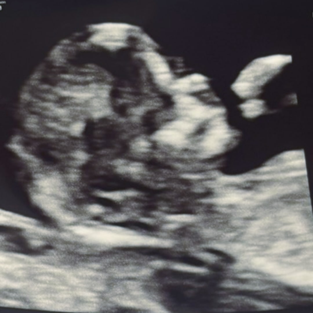 Photo shared by Maya for their Babylist baby registry.