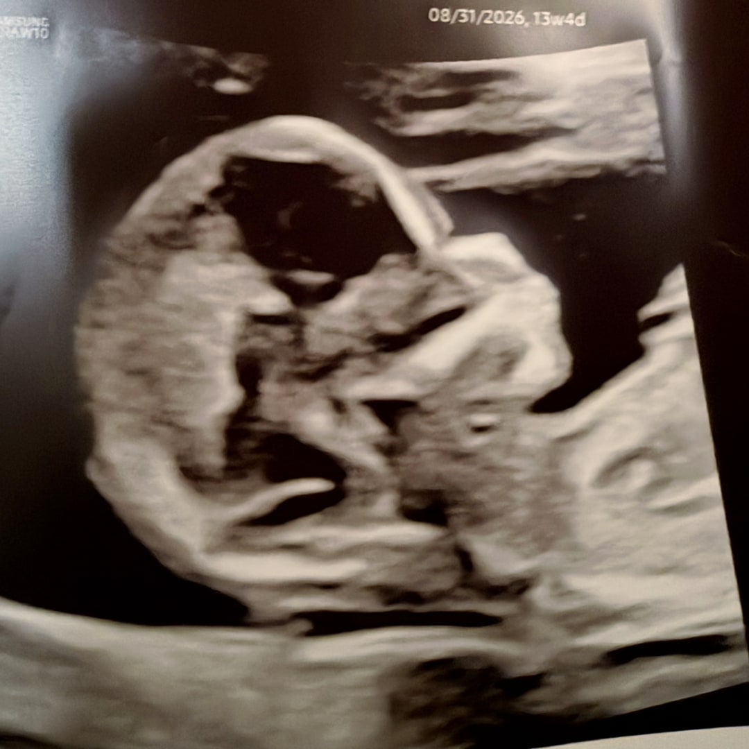 Photo shared by Angie for their Babylist baby registry.