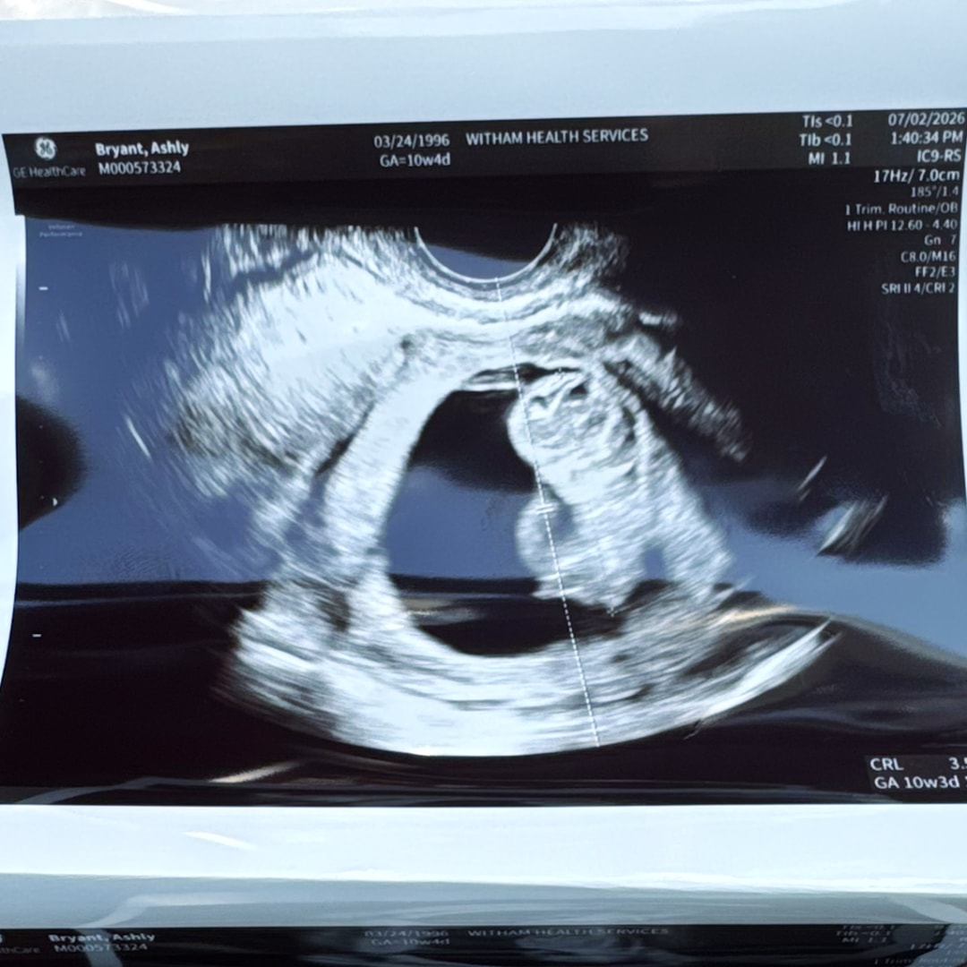 Photo shared by Ashly for their Babylist baby registry.