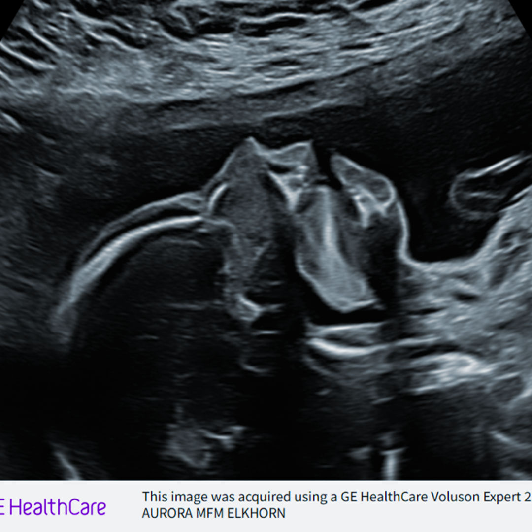 Photo shared by Kaitlyn for their Babylist baby registry.