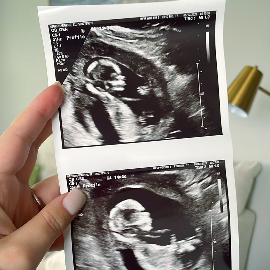 Photo shared by Bianca for their Babylist baby registry.