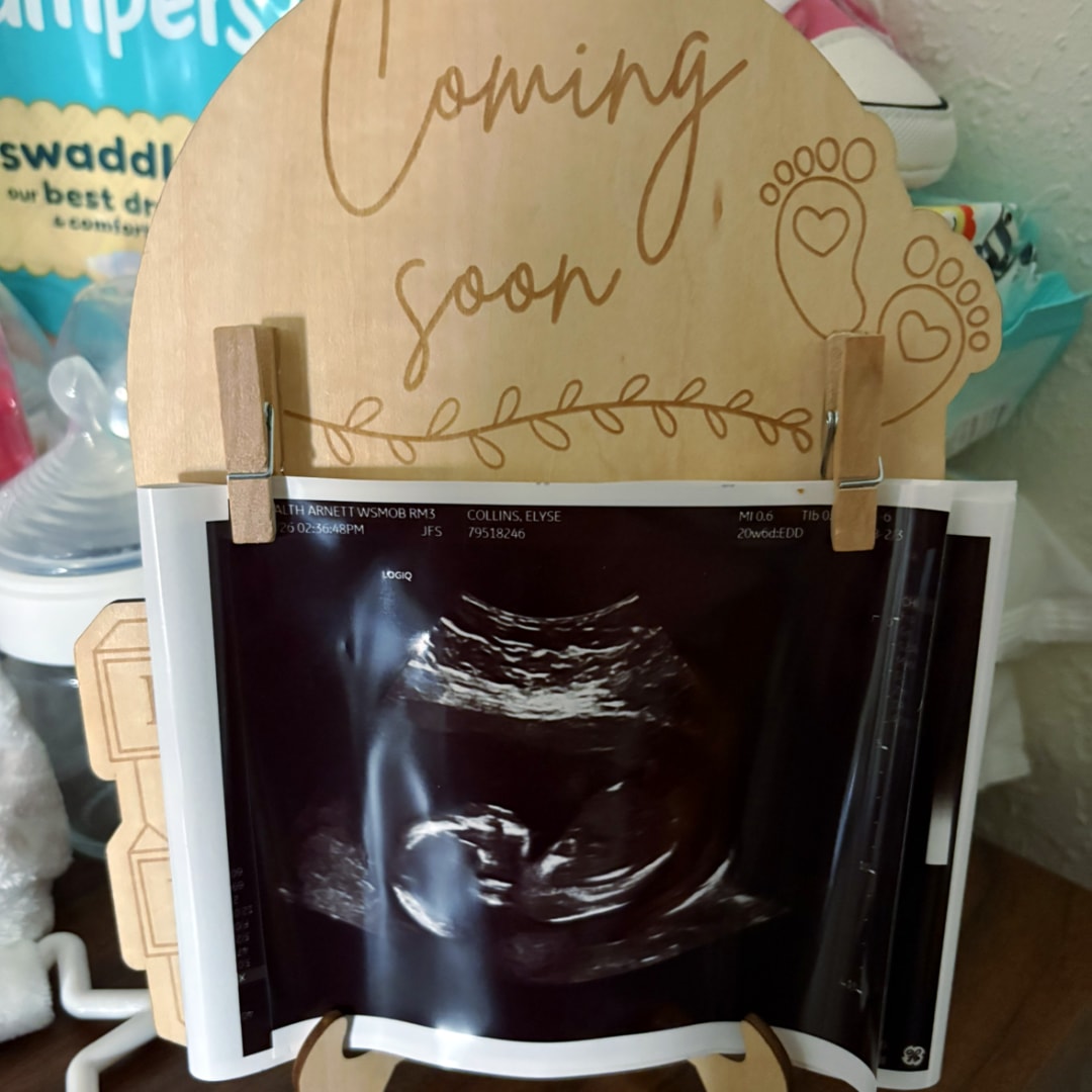 Photo shared by Elyse for their Babylist baby registry.