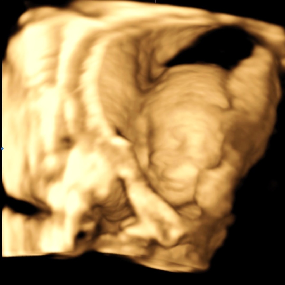 Photo shared by Kaylee for their Babylist baby registry.