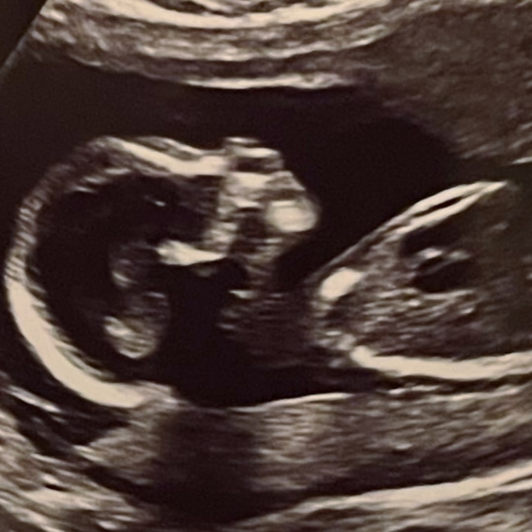 Photo shared by Stacy for their Babylist baby registry.