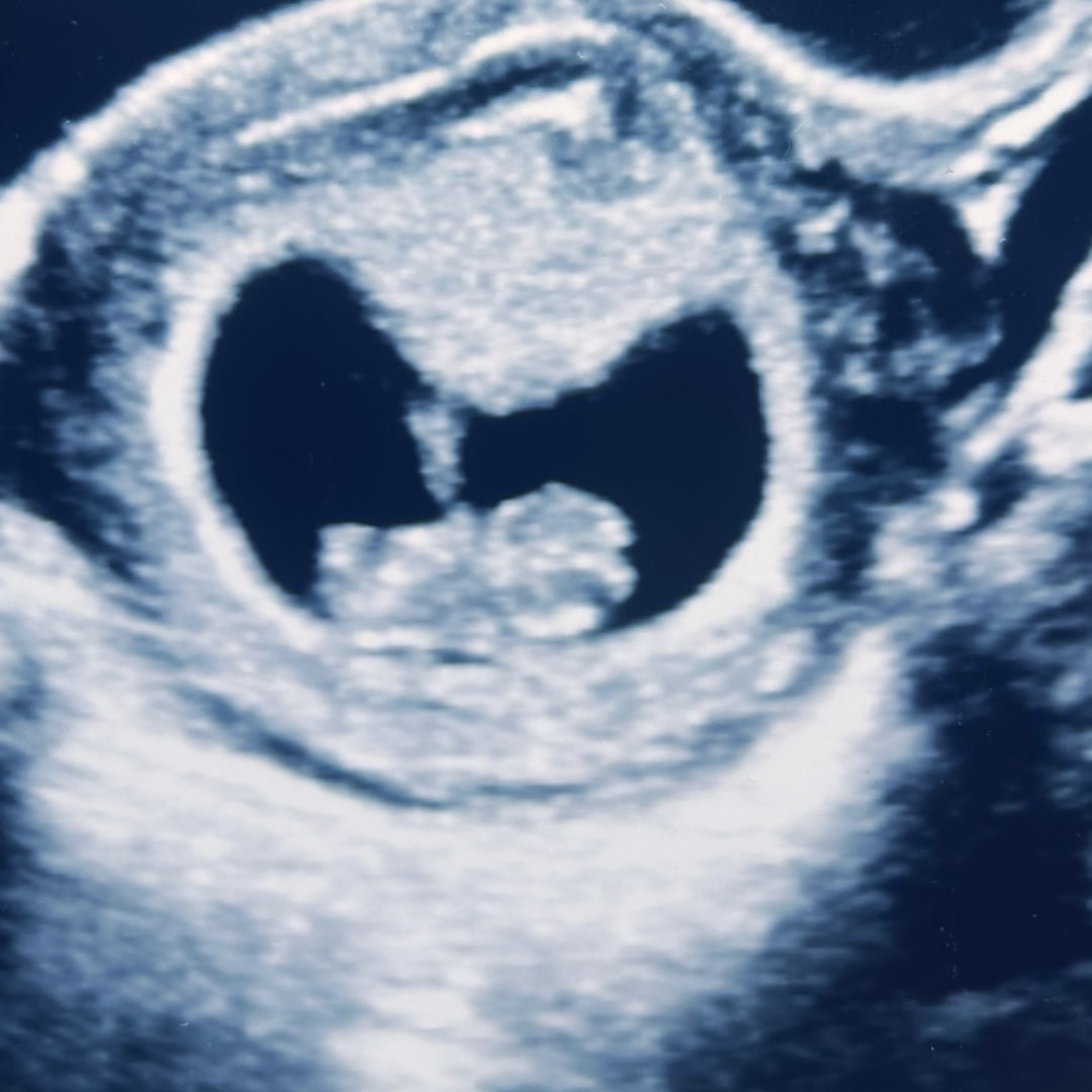 Photo shared by Akire for their Babylist baby registry.