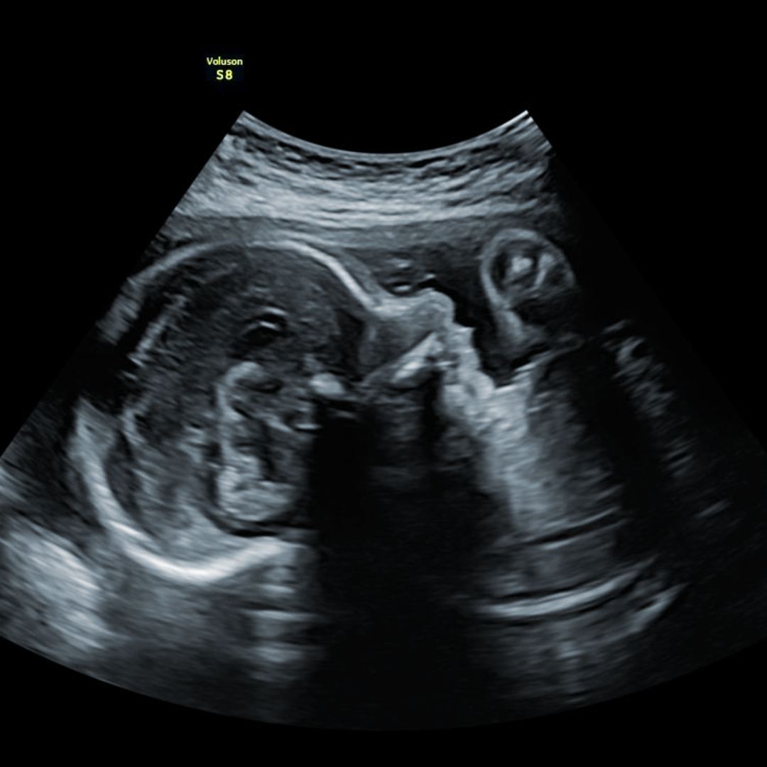 Photo shared by Haley for their Babylist baby registry.