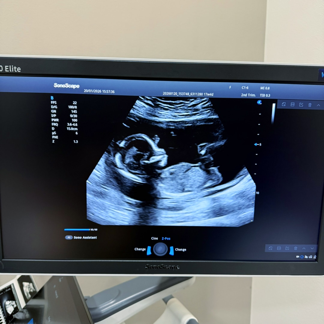 Photo shared by Austin and Bailey for their Babylist baby registry.