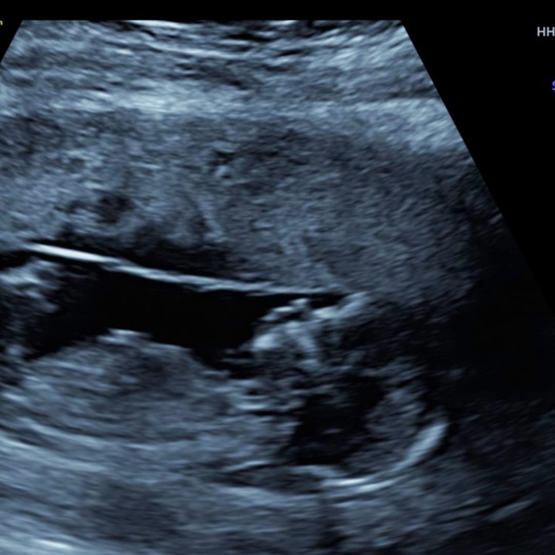 Photo shared by Celeste for their Babylist baby registry.