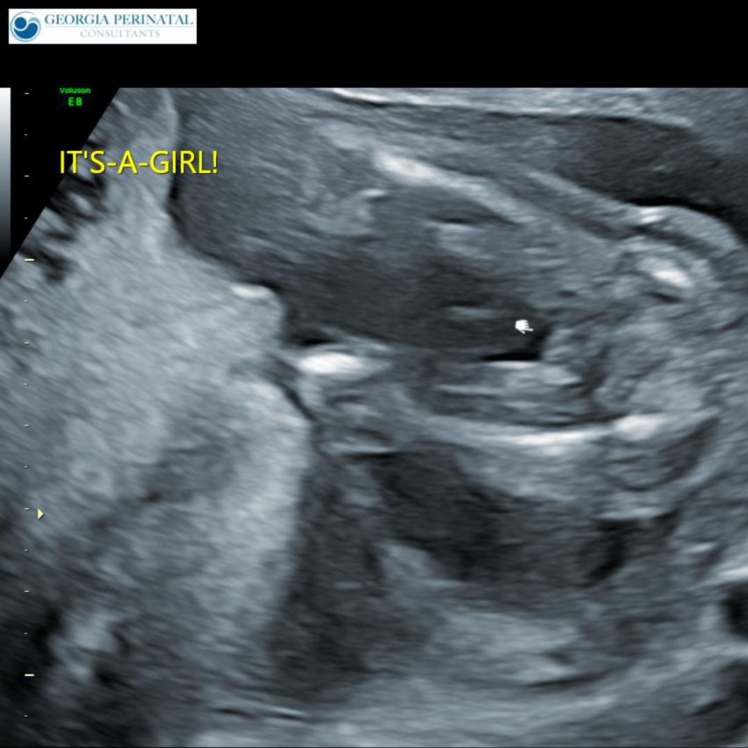 Photo shared by Olivia for their Babylist baby registry.
